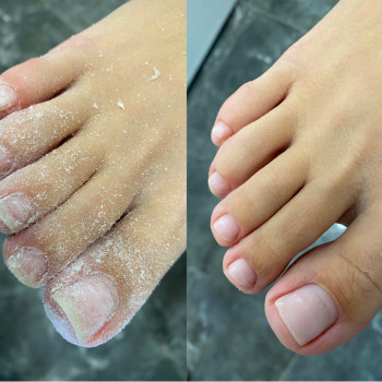 Комплексный педикюр (сложные стопы)
                    Мастер маникюра Виктория Одесса