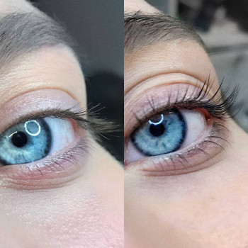 Ламінування До і Після