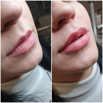 Наталья Вдовиченко, Вінниця Фото - 82