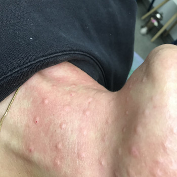 Наталья Вдовиченко, Вінниця Фото - 99