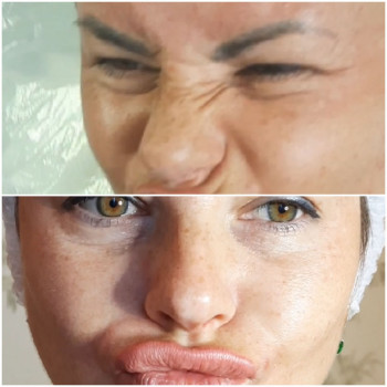 Нос и глаза