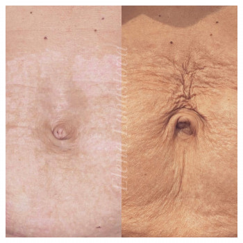 Плазменная шлифовка