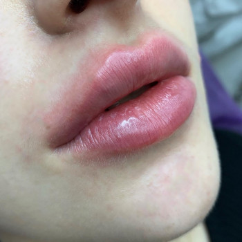 Іріс, Тернополь Фото - 28