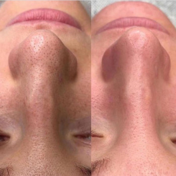 Ирина Булгар, Одесса Фото - 19