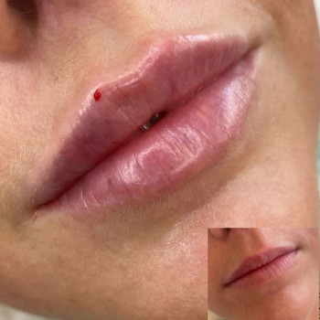 Ирина Булгар, Одесса Фото - 20