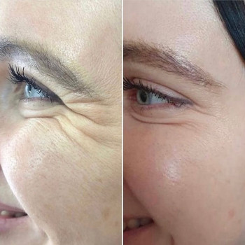 Ирина Булгар, Одесса Фото - 21