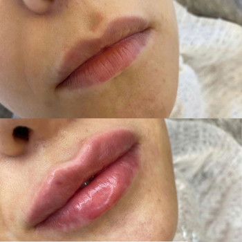 Ирина Булгар, Одесса Фото - 24