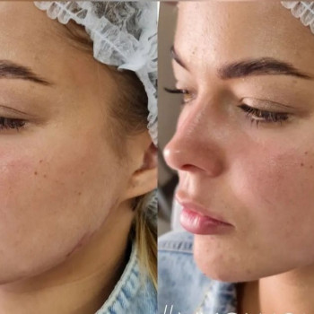 Ирина Булгар, Одесса Фото - 25