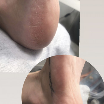 Фото 
До/Після 

Зміни одразу помітні ?