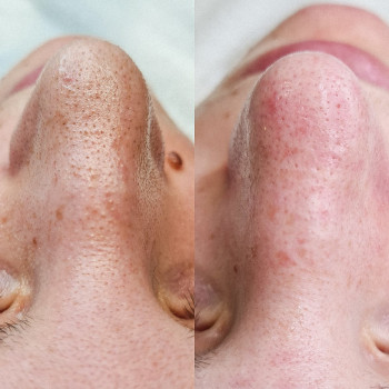 Евгения Панченко, Харьков Фото - 28