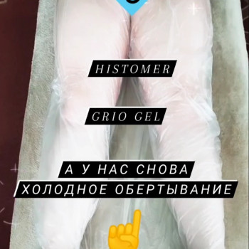 Олена Стоєва, Кропивницький Фото - 11