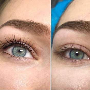 Ламінування +Botox