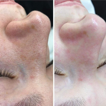 Салон красоты, Першотравенськ Фото - 15