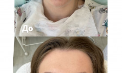 Профессиональная чистка лица Медичний центр DAARISE Миколаїв