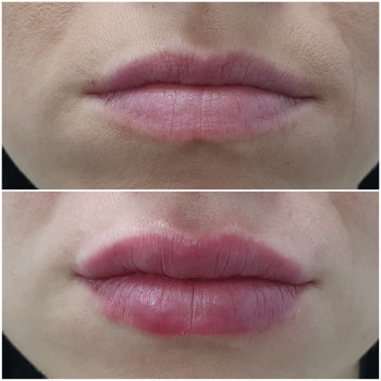 Вікторія Черван, Київ Фото - 6