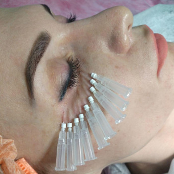 Мезонити Тредлифтинг
                    Косметолог Дарья Мариуполь