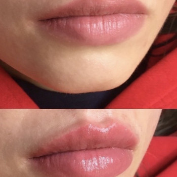 Татуаж губ увеличение, фото - Салон красоты Muramur