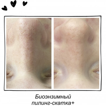 уход за лицом, косметология лица