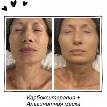 AD Line, Киев Фото - 7