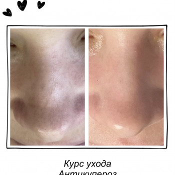 уход за лицом