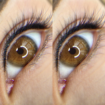 Межресничка