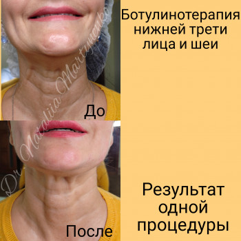 Наталия Мартыненко, Сумы Фото - 39