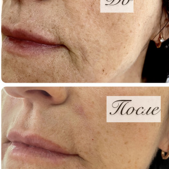 Татьяна Янковская, Днепр Фото - 5