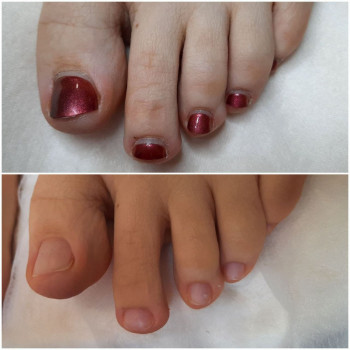 Аппаратный педикюр
                    Салон красоты BeautySkin Киев