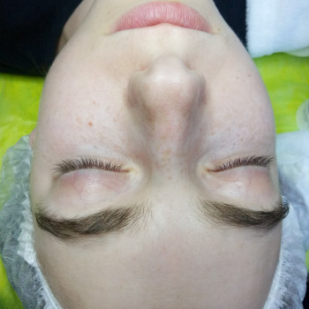 PRX-T33 пилинг
                    Салон красоты BeautySkin Киев