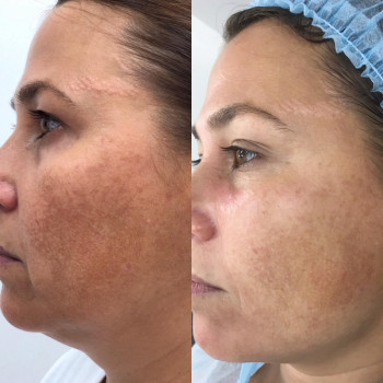 Ірина Круковець, Луцьк Фото - 18