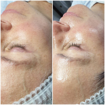 Ірина Круковець, Луцьк Фото - 22