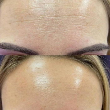 Ірина Круковець, Луцьк Фото - 26