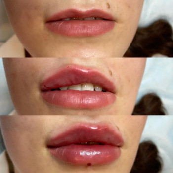 Ірина Круковець, Луцьк Фото - 30