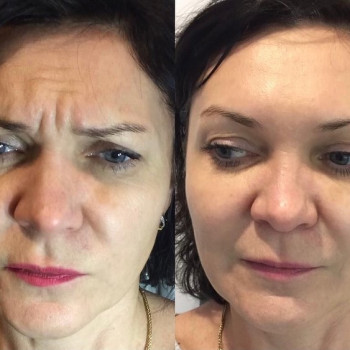 Ірина Круковець, Луцьк Фото - 32