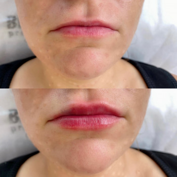 Ірина Круковець, Луцьк Фото - 38