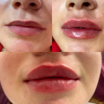 Ірина Круковець, Луцьк Фото - 39