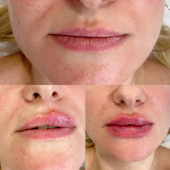 Ірина Круковець, Луцьк Фото - 43