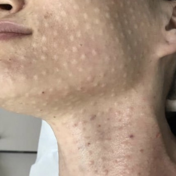 Ірина Круковець, Луцьк Фото - 44