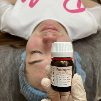 Азелаиновый пилинг Simildiet
                    Салон краси NC Cosmetology Київ