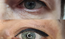 Безоперационная блефаропластика Майстер перманентного макіяжу Марьяна Ужгород