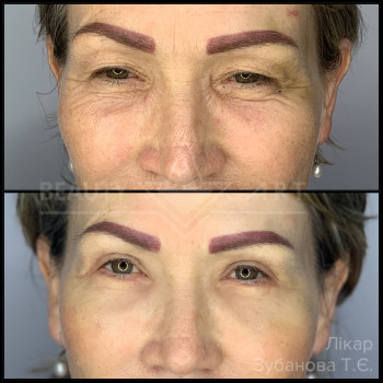 Фото з портфоліо фахівця Тетяна Зубанова (пластичний хірург, Луцьк)
