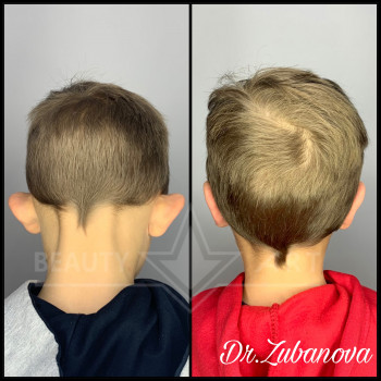 Фото з портфоліо фахівця Тетяна Зубанова (пластичний хірург, Луцьк)