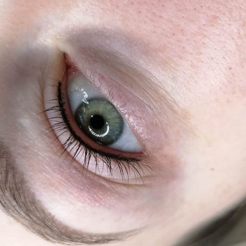 Межресничка.