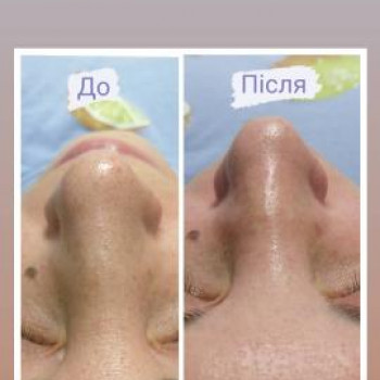 Юлія Ярема, Львов Фото - 9