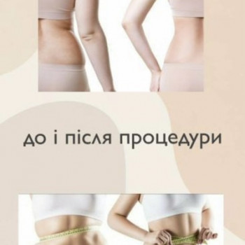 STUDIO B&M, Тернопіль Фото - 8