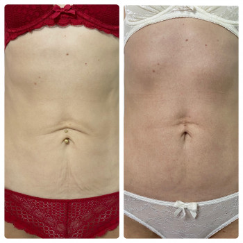 Kvitka Lotosa, Ирпень Фото - 24