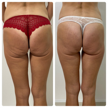 Kvitka Lotosa, Ирпень Фото - 25