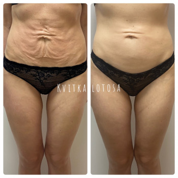 Kvitka Lotosa, Ирпень Фото - 26