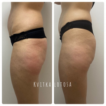 Kvitka Lotosa, Ирпень Фото - 27