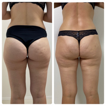 Kvitka Lotosa, Ирпень Фото - 30